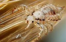 Male_human_head_louse.jpg
